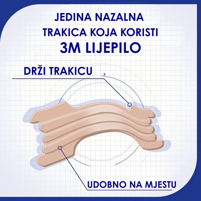 Nazalne Trakice Za Nos