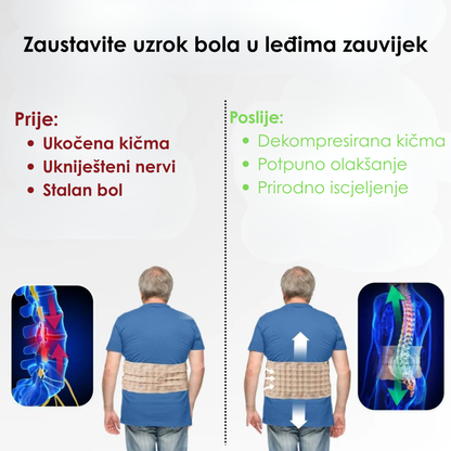Spinaline Dekompresioni Pojas za Leđa