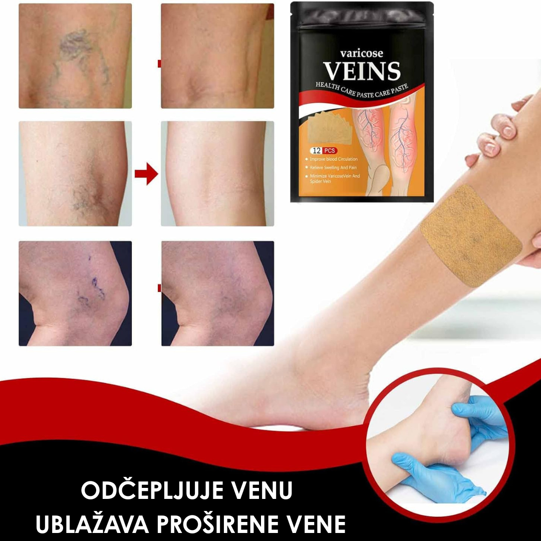 Flasteri Za Olakšanje Otečenim i Umornim Nogama (12 Komada)