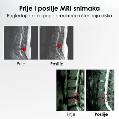 Spinaline Dekompresioni Pojas za Leđa
