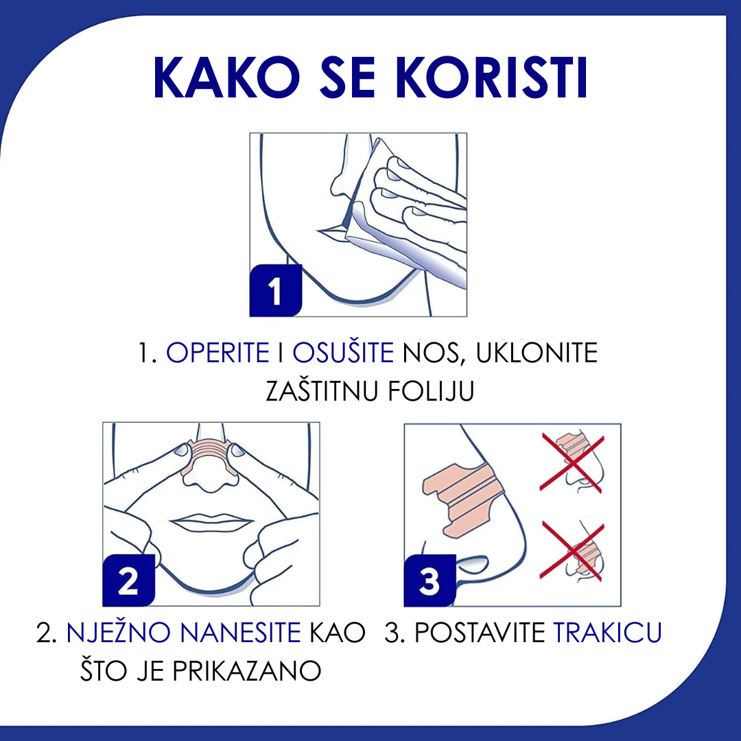 Nazalne Trakice Za Nos