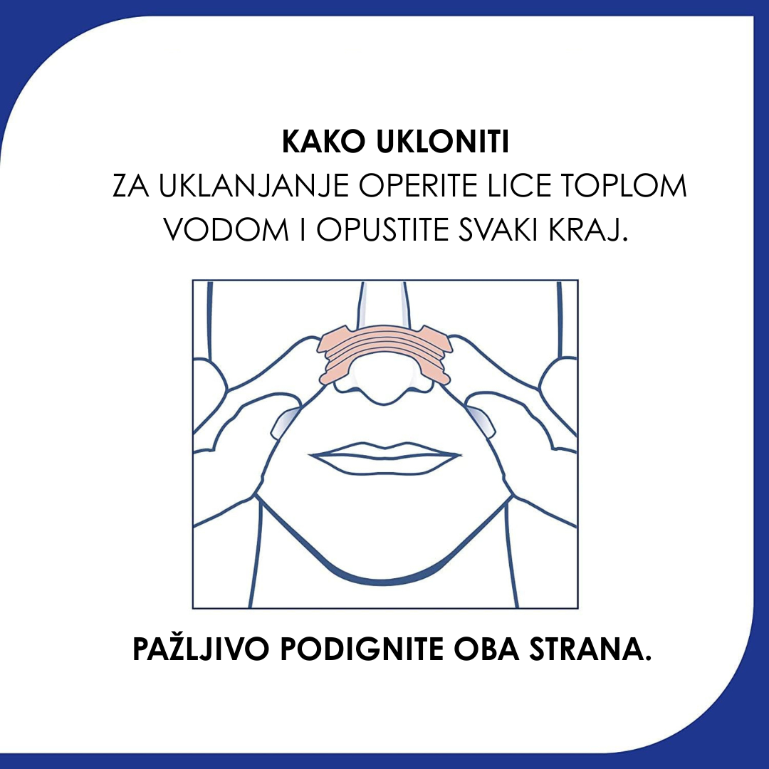 Nazalne Trakice Za Nos