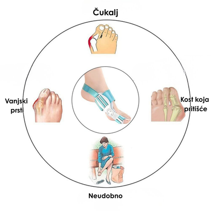 Korektor za Ispravljanje Prstiju sa Silikonskim Jastučićem